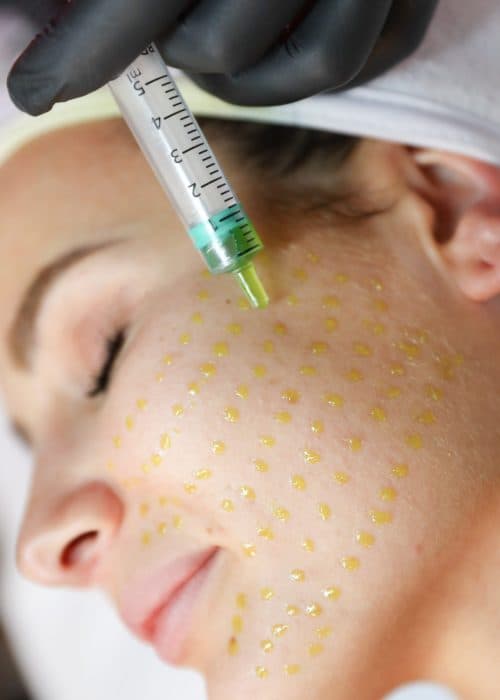 BioRePeel at Rani Beauty Clinic