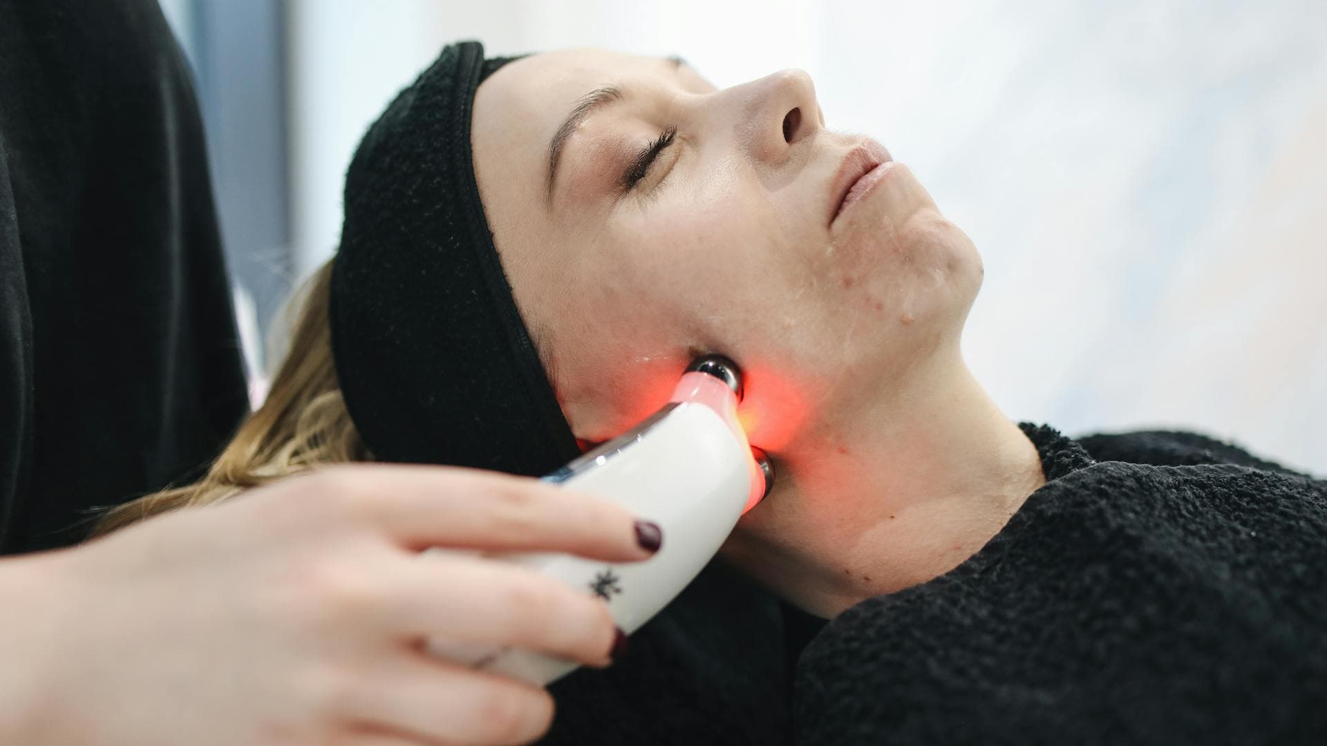 Laser Hair Removal - before treatment at Rani Beauty Clinic