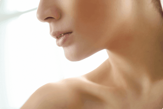 Botox & Dysport Before & After result 3